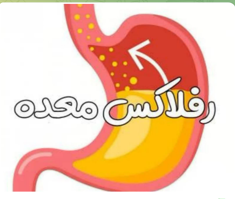رفلاکس معده؟؟؟